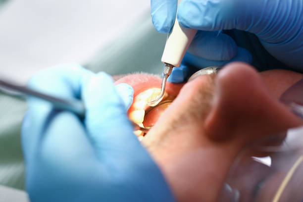 Best Pediatric Emergency Dentist in Millville, DE